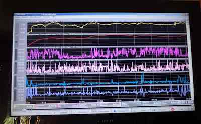 Biofeedback Werte